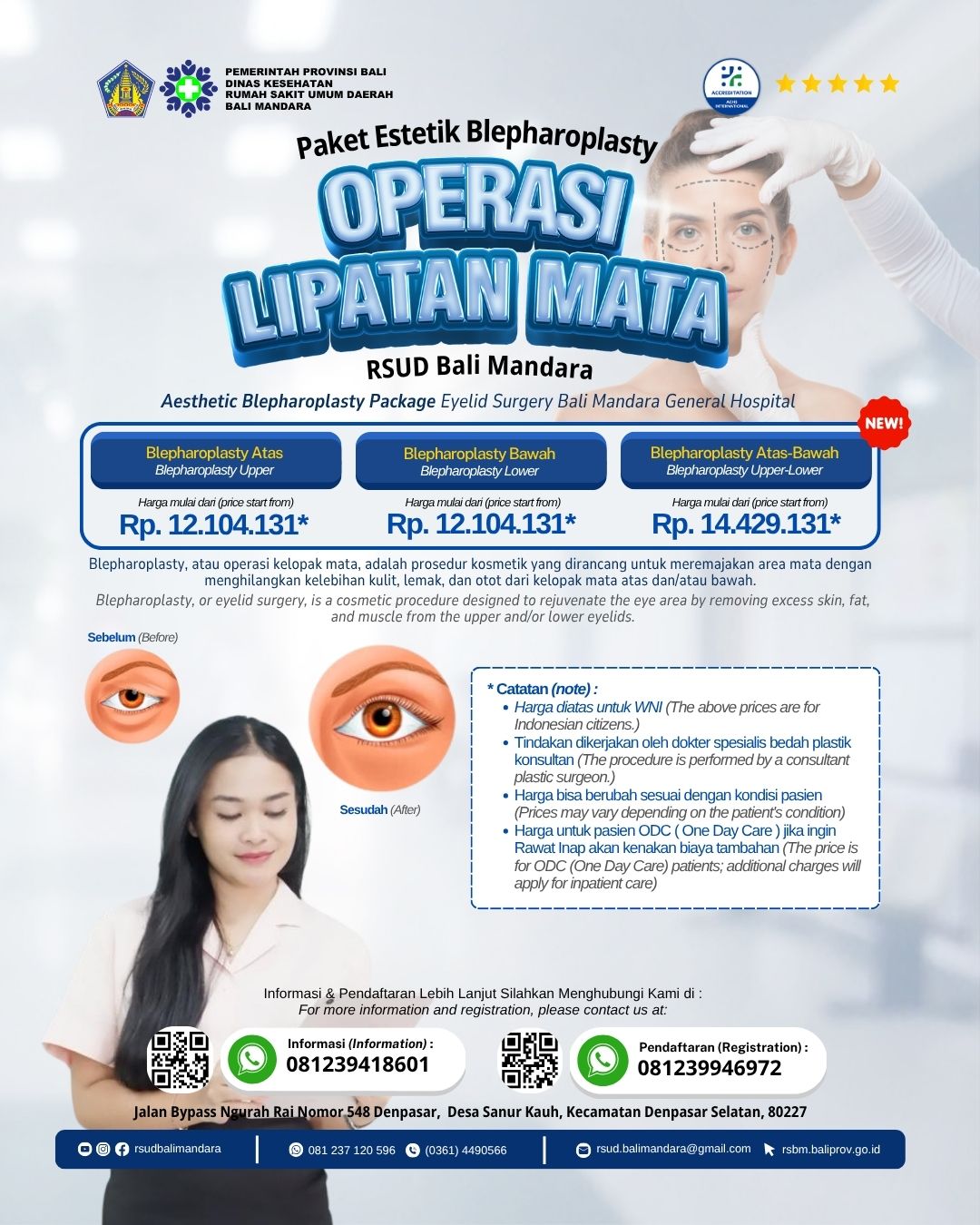 Paket Blepharoplasty ( Operasi Lipatan Mata ) Atas